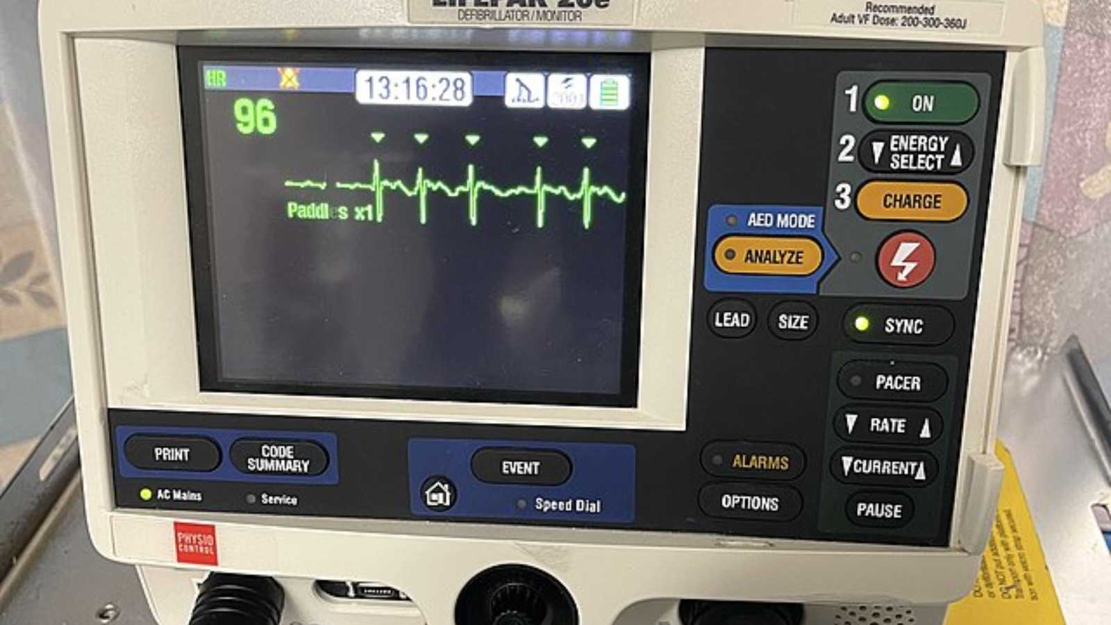 Reasons why running slowly may be better for the heart